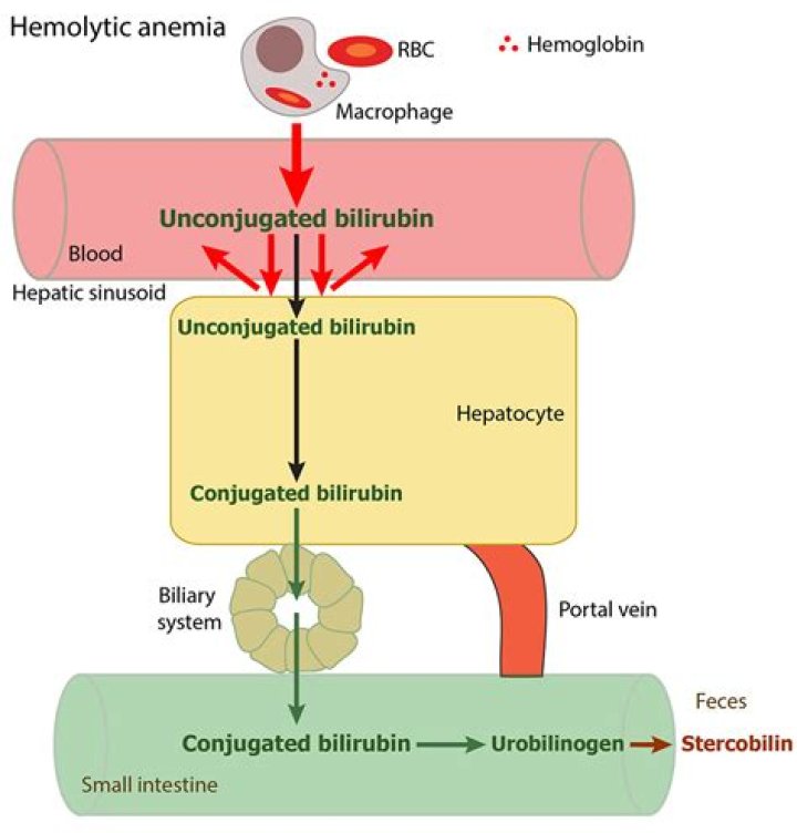 What does high conjugated bilirubin mean?