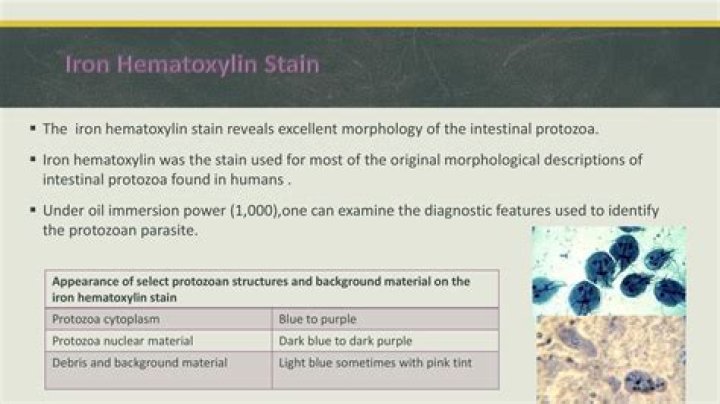 What does Iron hematoxylin Stain?