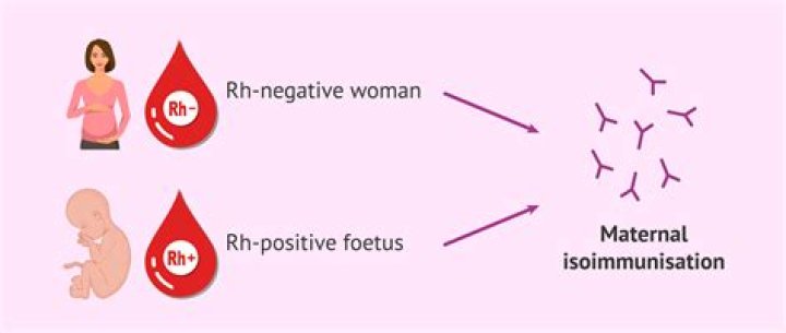 What does it mean when a woman is Rh negative?