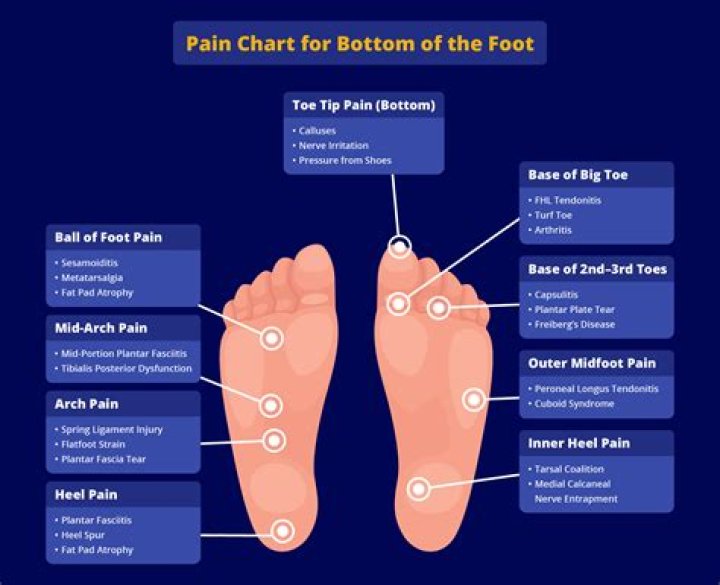 What does it mean when the inner side of your foot hurts?