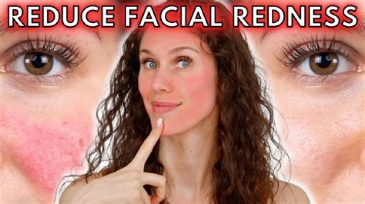 What does it mean when your face is really red?