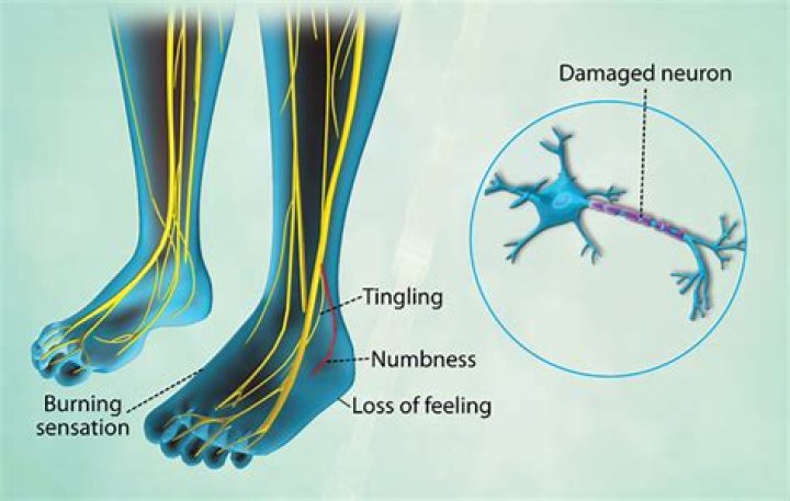 What does it mean when your feet are throbbing?