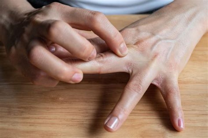 What does it mean when your hands and feet itch during pregnancy?