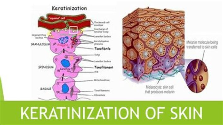What does Keratinization mean?