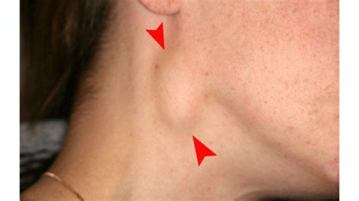 What does redness on the neck mean?