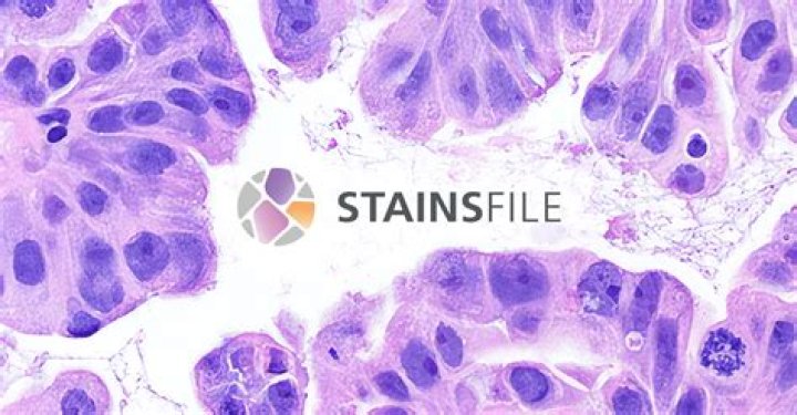 What does staining a slide do?
