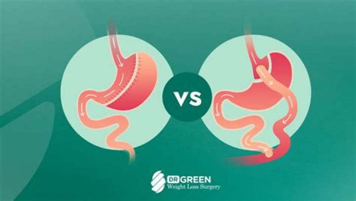 What does stomach stapling do?