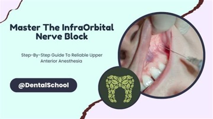 What does the infraorbital nerve block anesthetize?