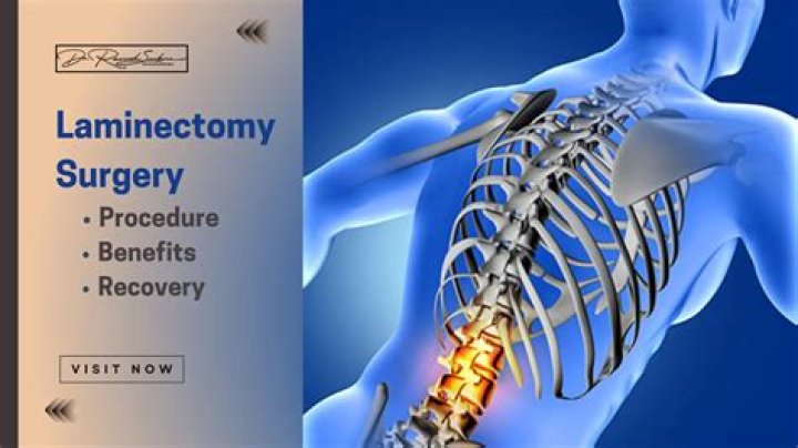 What does the word Laminectomies mean?