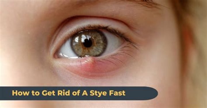 What happens if a stye gets infected?