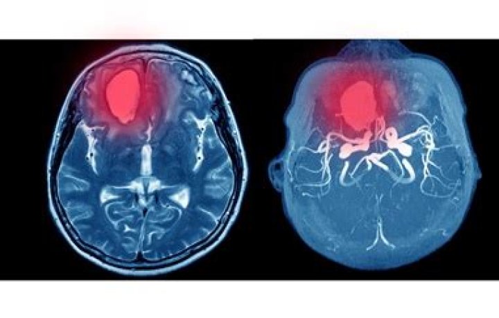 What happens if cerebral cortex is damaged?