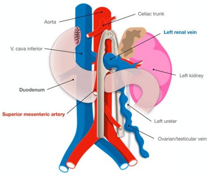 What happens if inferior mesenteric artery is blocked?