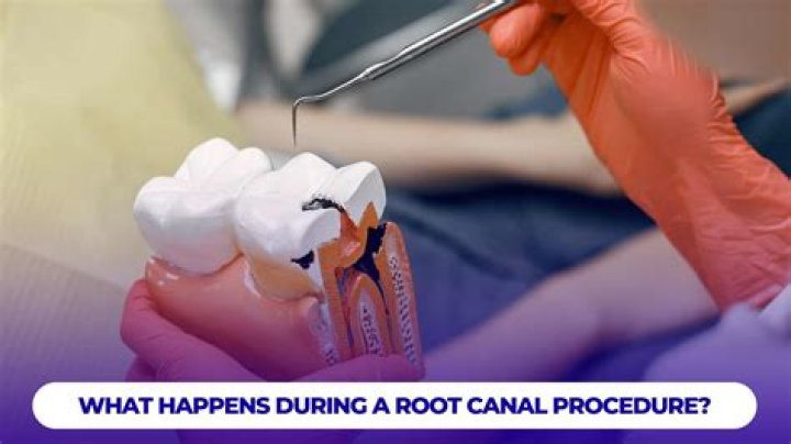 What happens if the root canal has been excessively removed of tooth structure for post insertion?