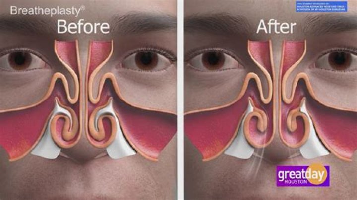 What happens if you breathe in rat feces?