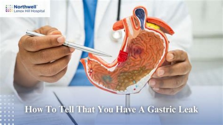 What happens if you have a leak after gastric sleeve?