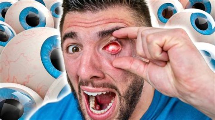 What happens if your eyeballs fall out?