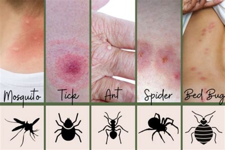What insect causes multiple bites in one area?