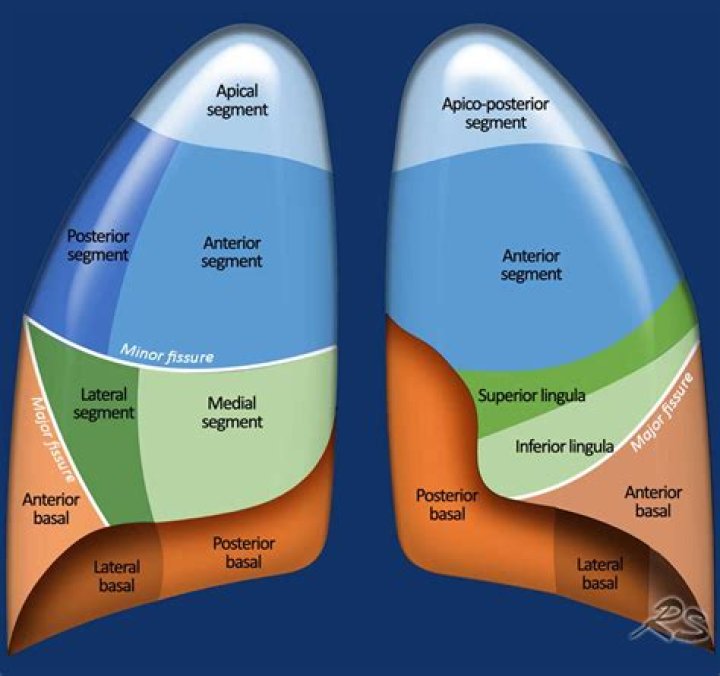 What is a apical lung mass?
