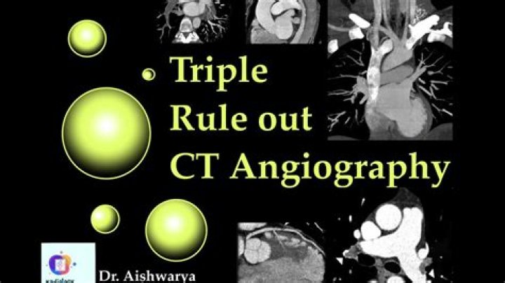 What is a CT Triple rule out?