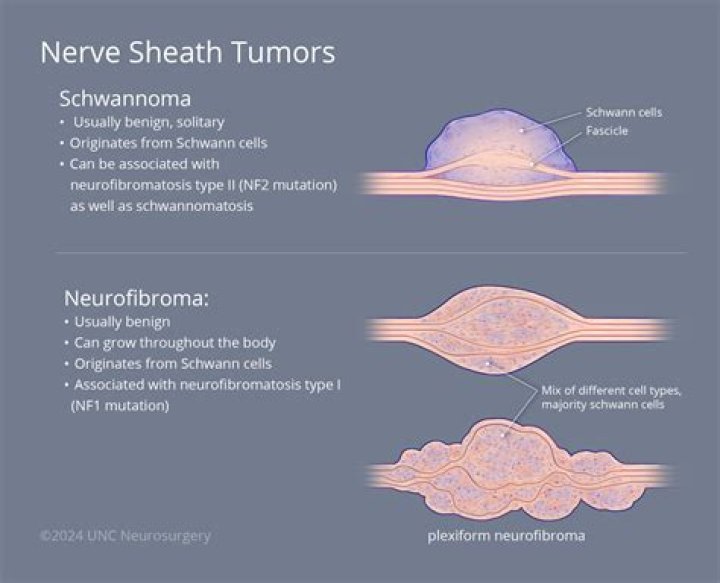 What is a granular growth or tumor?