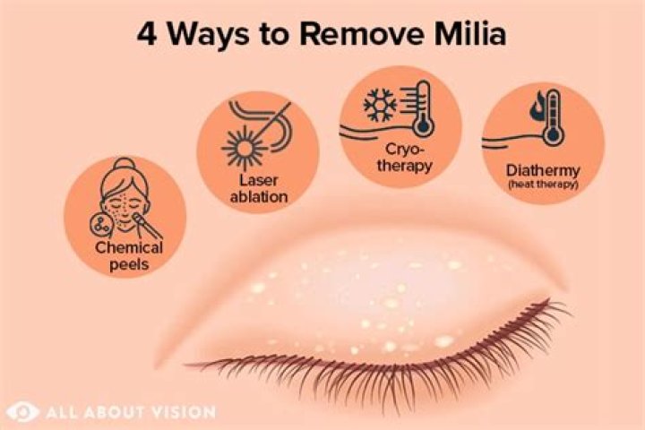 What is a little white dot on eyelid?