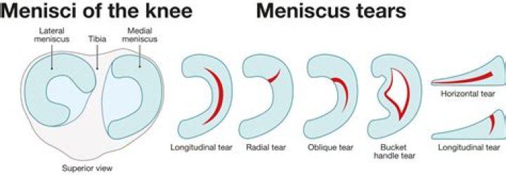 What is a mensis?