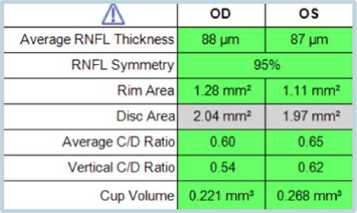 What is a normal average RNFL thickness?