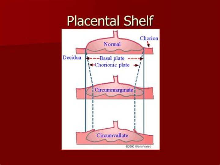 What is a placental shelf?
