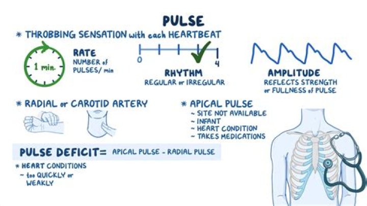 What is a plie pulse?