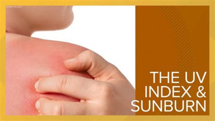 What is a possible danger associated with sunburn?