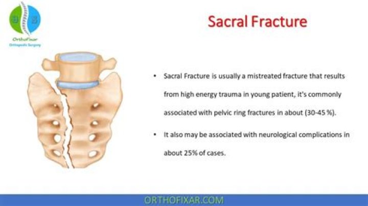 What is a sacral shear?