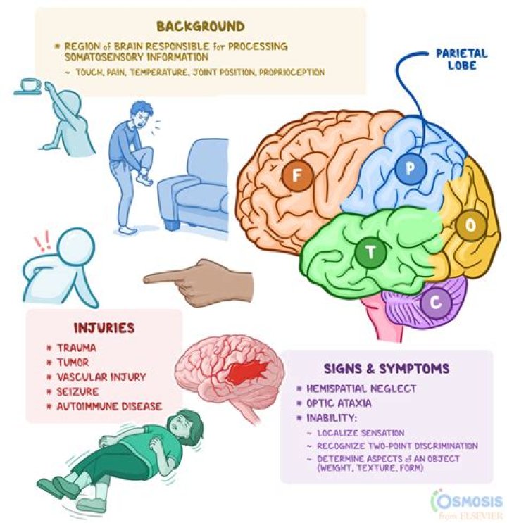 What is a sensory stroke?