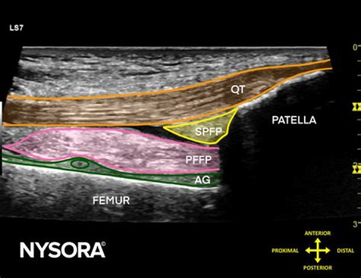 What is a stand off pad in ultrasound?