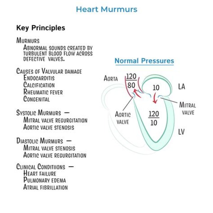 What is an ejection type murmur?