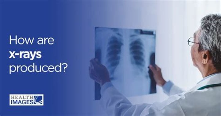 What is an X-ray reader called?