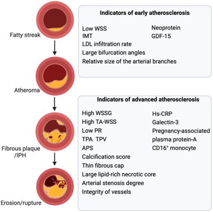 What is atherosclerosis ulcer?