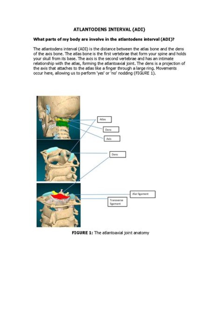 What is atlanto interval?