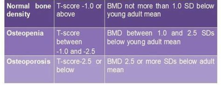What is BMD test for osteoporosis?
