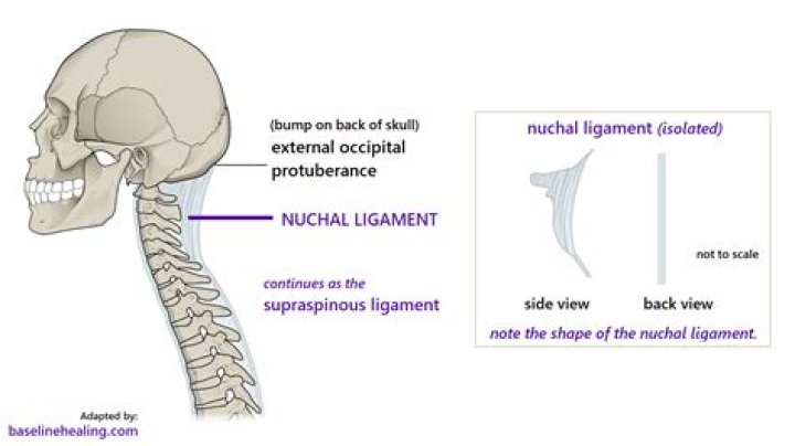 What is calcified nuchal ligament?