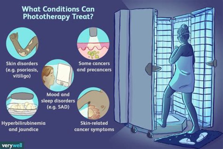 What is considered intensive phototherapy?