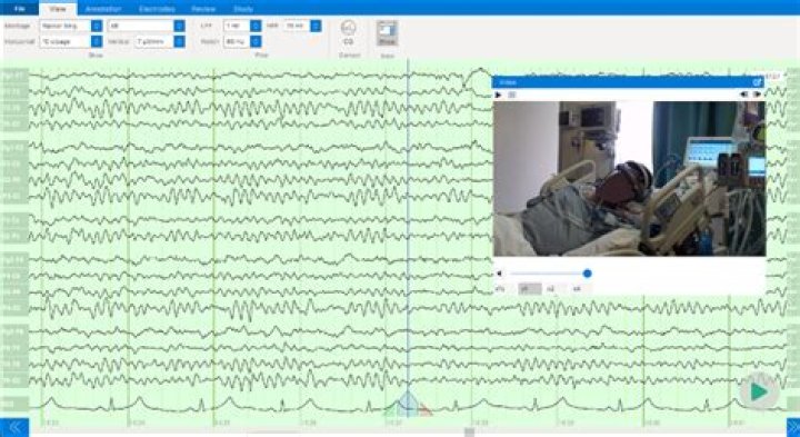 What is continuous video EEG monitoring?