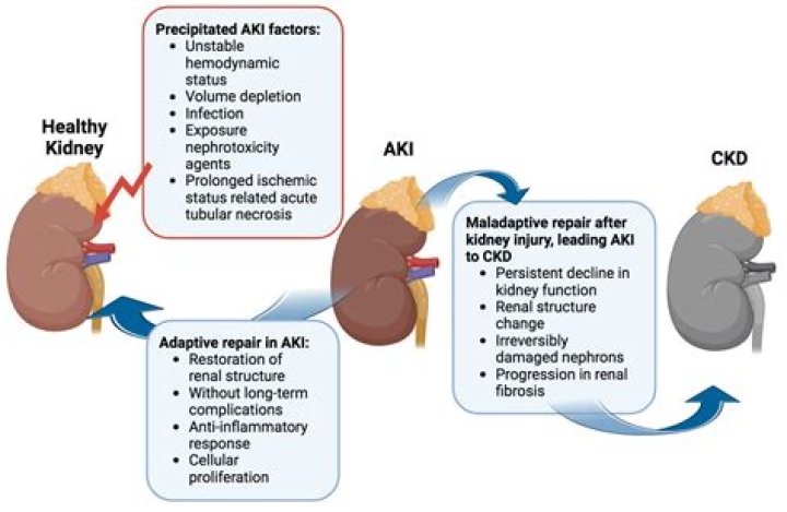 What is difference between CKD and CBU?
