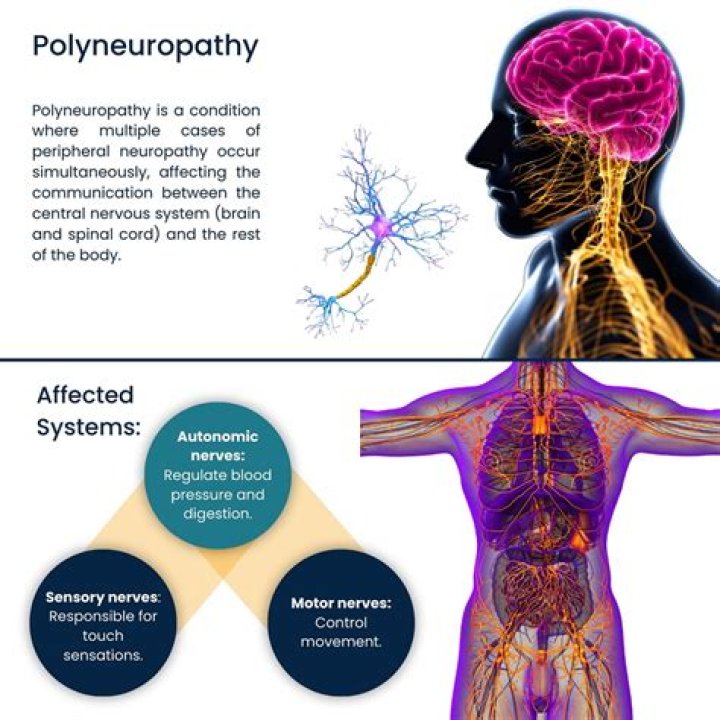What is equine Polyneuritis?