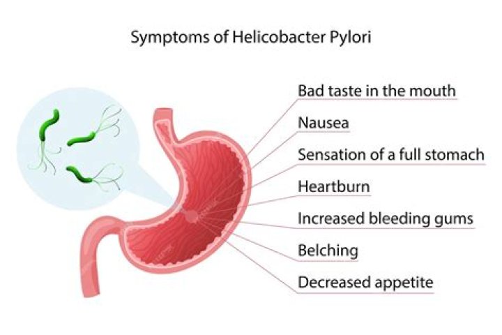 What is Helicobacter pylori Ag by EIA?