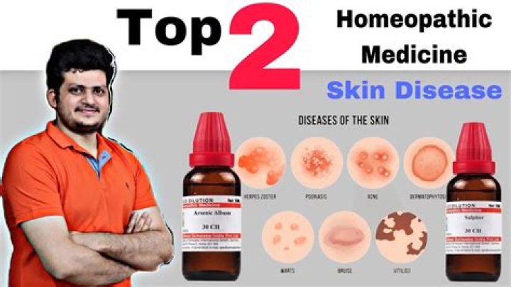 What is homeopathic chelidonium used for?