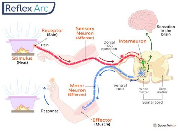 What is hyperactive Moro reflex?