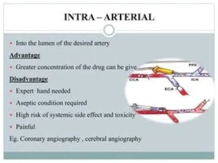 What is intra-arterial therapy?