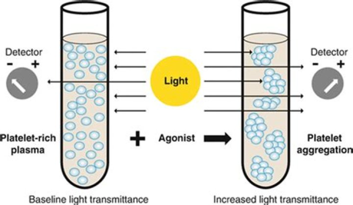 What is light transmission platelet aggregometry?