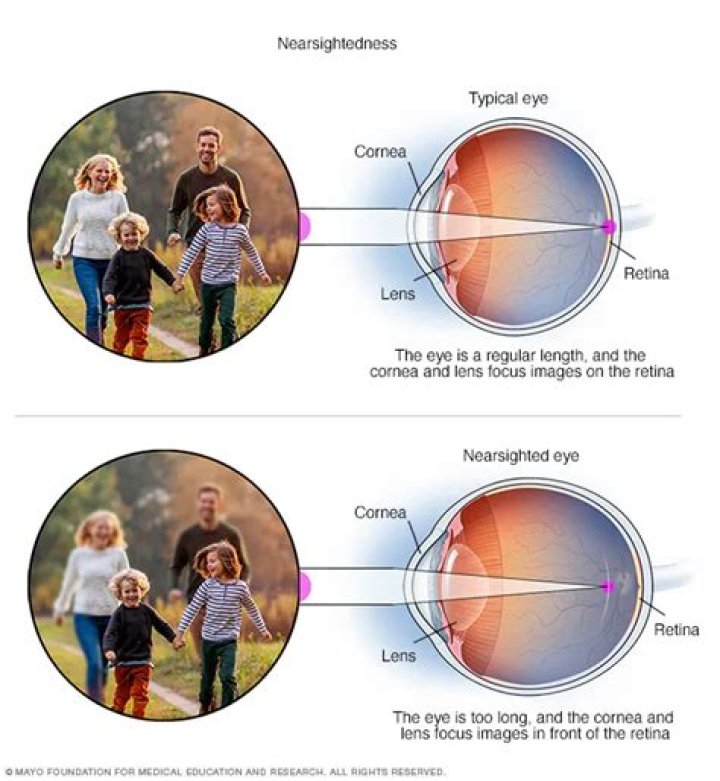 What is long sightedness in physics?