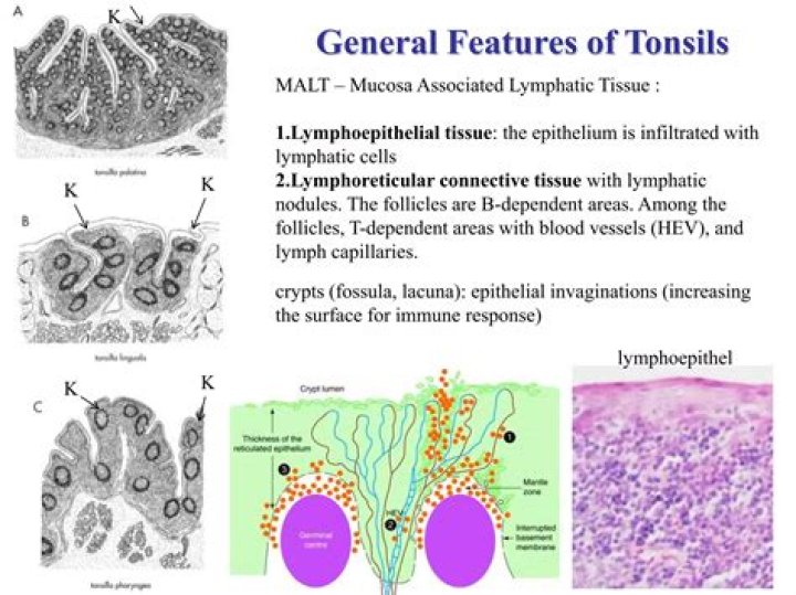 What is Lymphoreticular tissue?